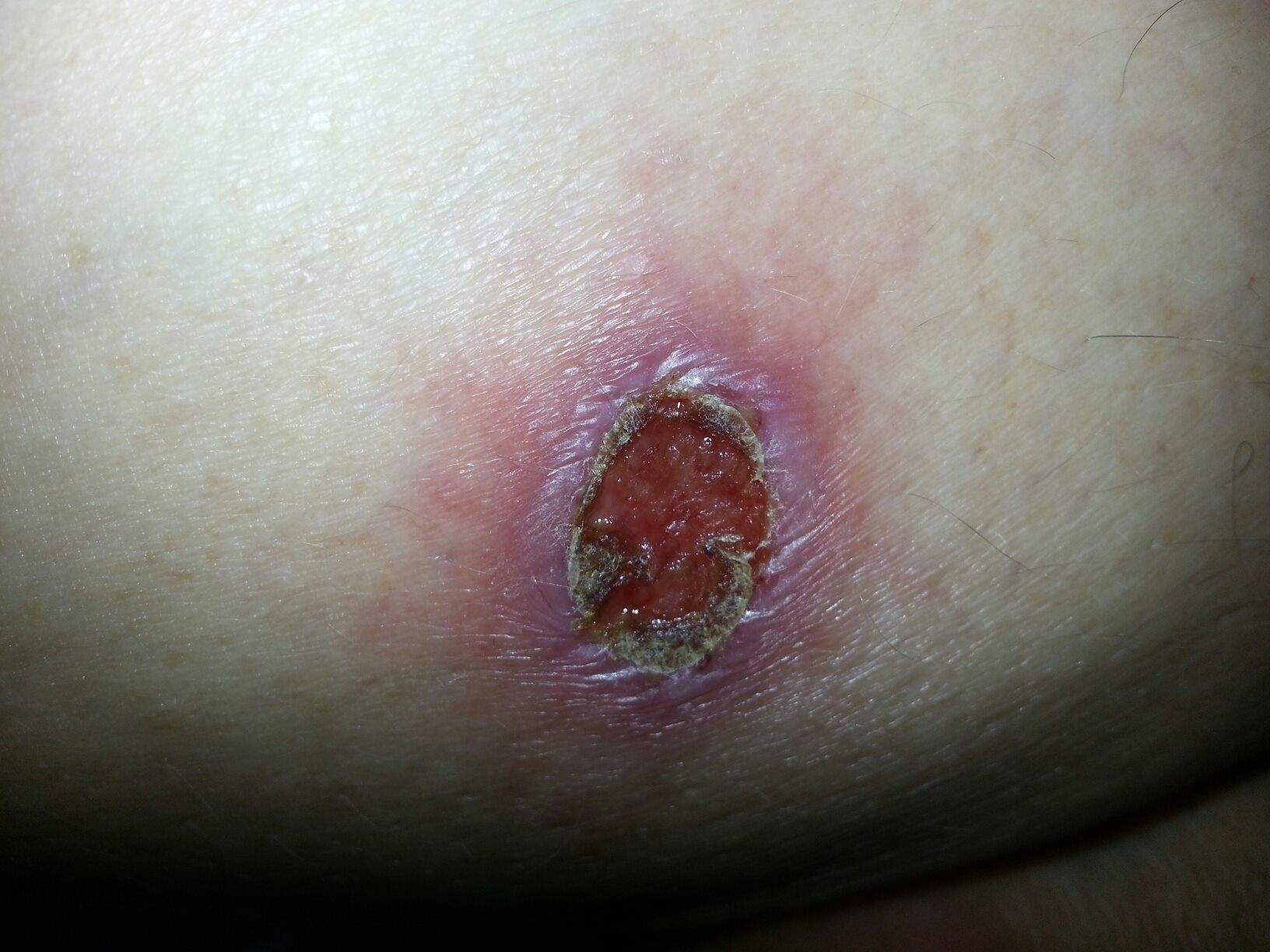 10700296_10153258673887971_806832505954340496_o